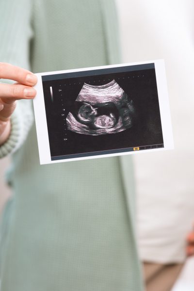 Pregnant woman holding ultrasound scan of baby and touching belly